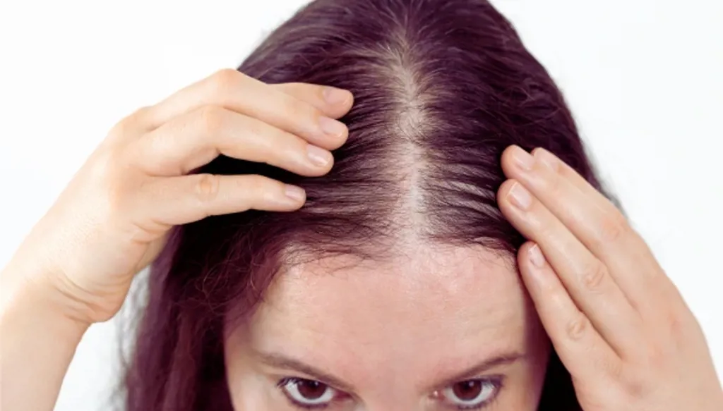 كيف يمكن تجنب تساقط الشعر؟
