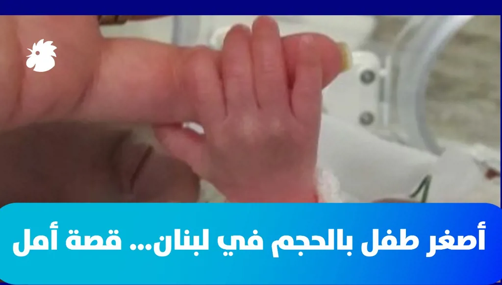 أصغر طفل بالحجم في لبنان… قصة أمل (فيديو)
