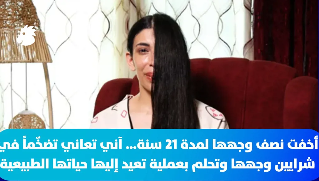 أخفت نصف وجهها لمدة 21 سنة… آني تحلم بعملية تعيد إليها حياتها الطبيعية
