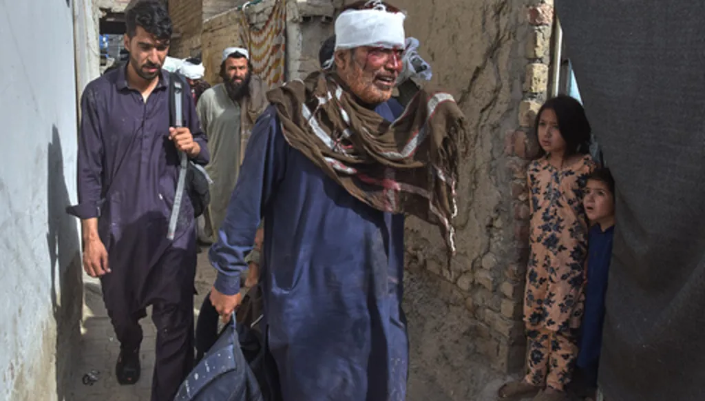 Children look at an injured person passing through an alley near the site of a bomb explosion in Quetta, Pakistan, Sunday, May 24, 2026. (AP Photo/Arshad Butt)