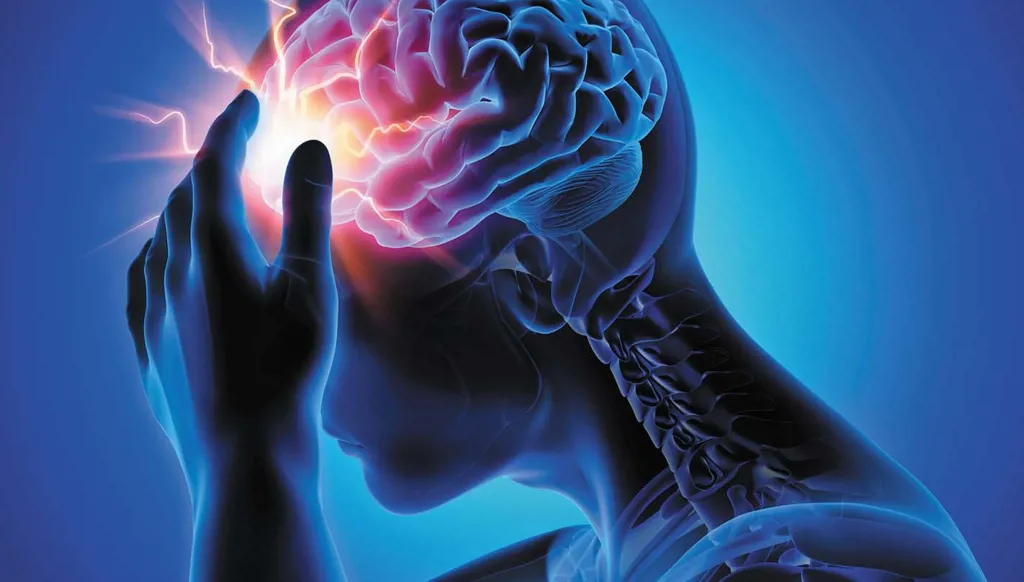 صداع التوتر جزء من آلام مشابهة قد يسهل علاجها