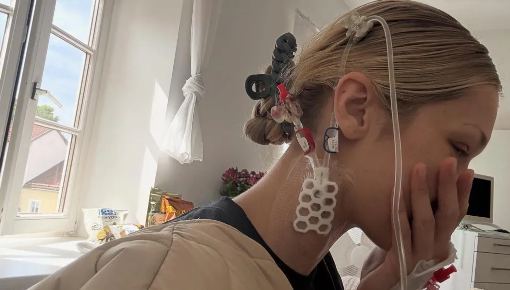 مرض لايم الذي أصاب بيلا حديد… هل للقراد صلة بحرب بيولوجية خبيثة؟