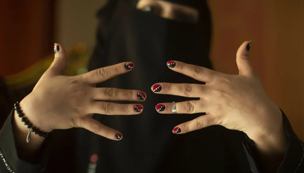 From accident to advocacy: The woman redefining disability in Yemen