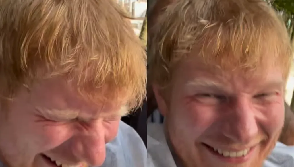 إد شيران يجرّب التدليك الهندي التقليدي "تشامبي": هذا نوع من التعذيب