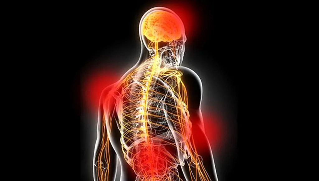 الفيبروميالجيا...الألم بلامرض بين الوهم والحقيقة