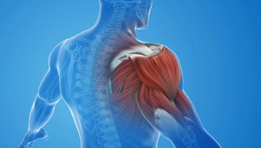 الكتف المتجمّدة... لمَ تُصيب النساء أكثر؟