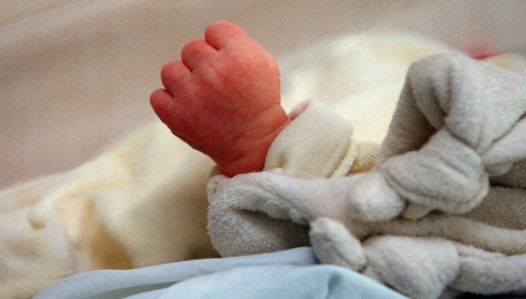 بالصورة - ولادة طفل "دون دماغ" في غزة... صدمة مع تزايد حالات تشوه الأجنة!