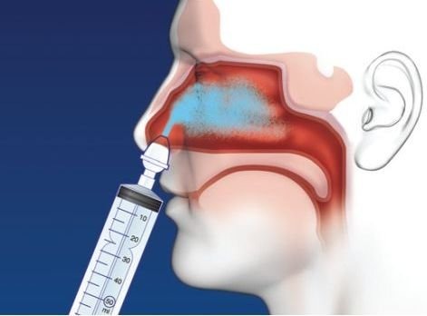 صورة تعبيرية.