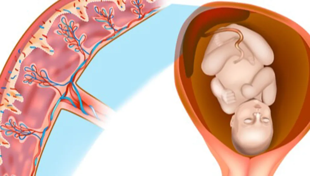 تطوير نموذج ذكاء اصطناعي يُمكنه الكشف عن أحد مضاعفات الحمل الخطيرة... ما هو "طيف المشيمة الملتصقة"؟