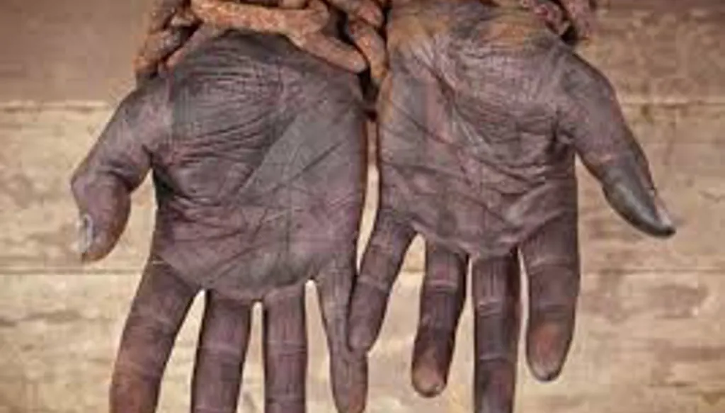 الأمم المتحدة: تجارة الرقيق في أفريقيا "أخطر جريمة ضد الإنسانية"