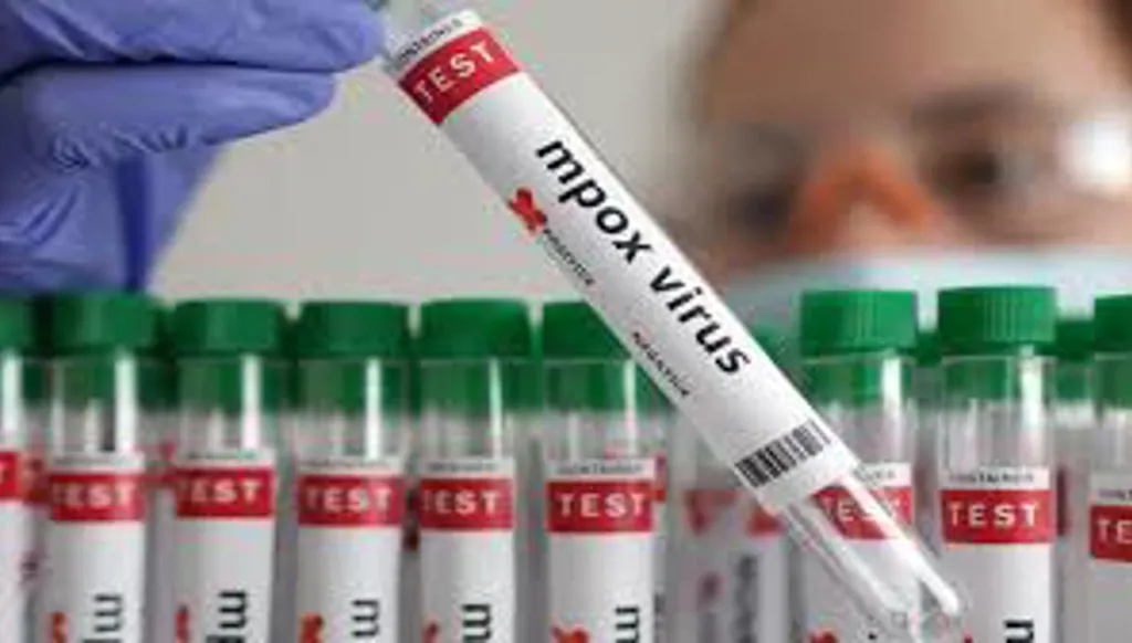 الصحة العالمية: الإمارات تسجل أول إصابة بسلالة جديدة من فيروس جدري القردة
