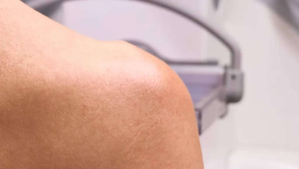 الصواب والخطأ حول الصورة الشعاعية للثدي