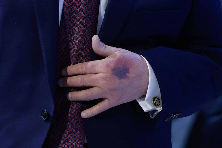 صورة متداولة لترامب