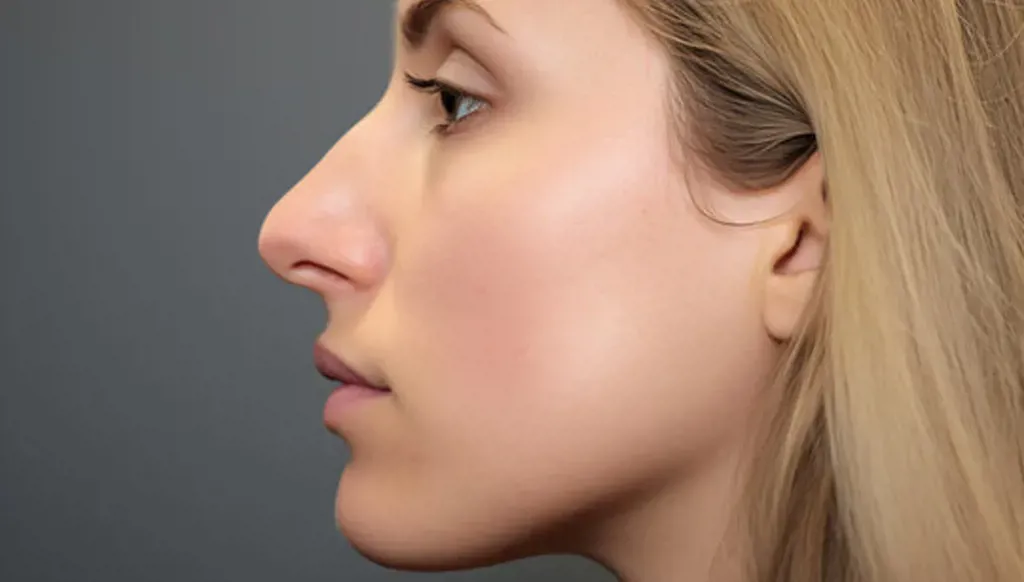 The Roman nose returns as beauty trends embrace bold features