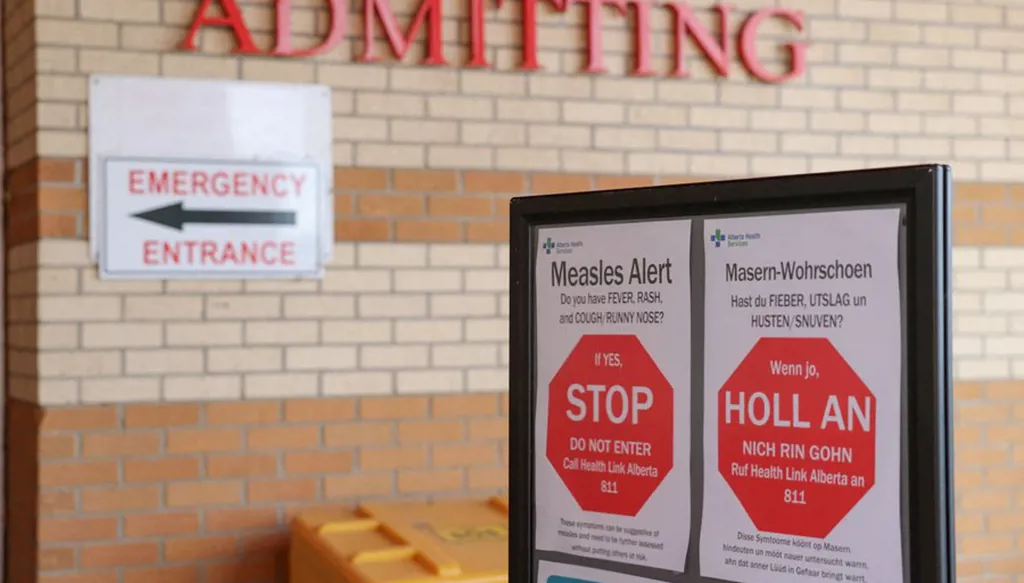 بعد 3 عقود...  كندا تفقد وضعها كدولة "خالية من الحصبة"