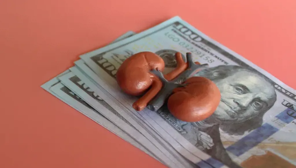 العراق يفكّك شبكة يُشتبه باتجارها بالكلى… ووثائق مزوّرة لتغطية نشاطها