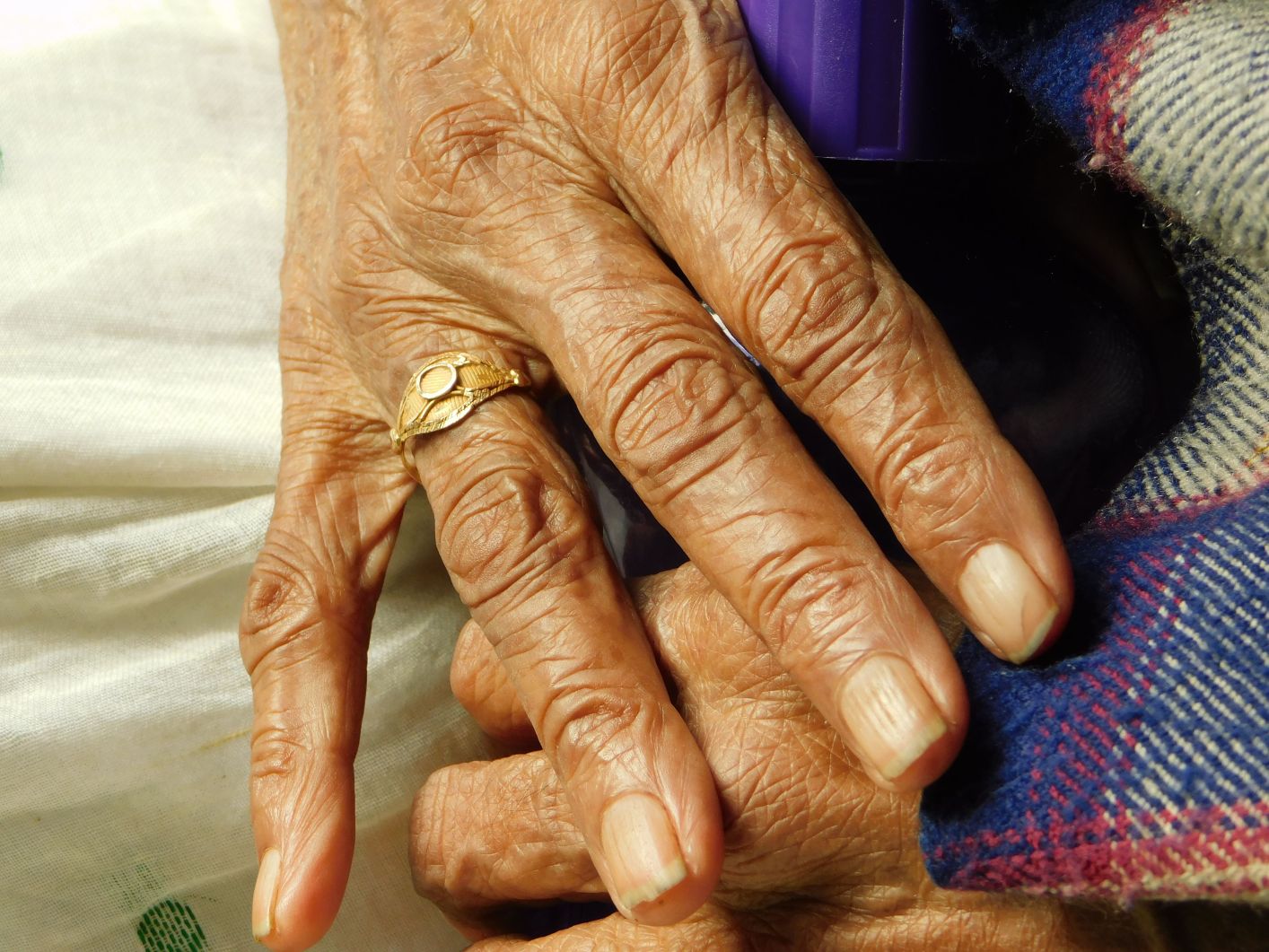 شيخوخة اليدين (pexels).