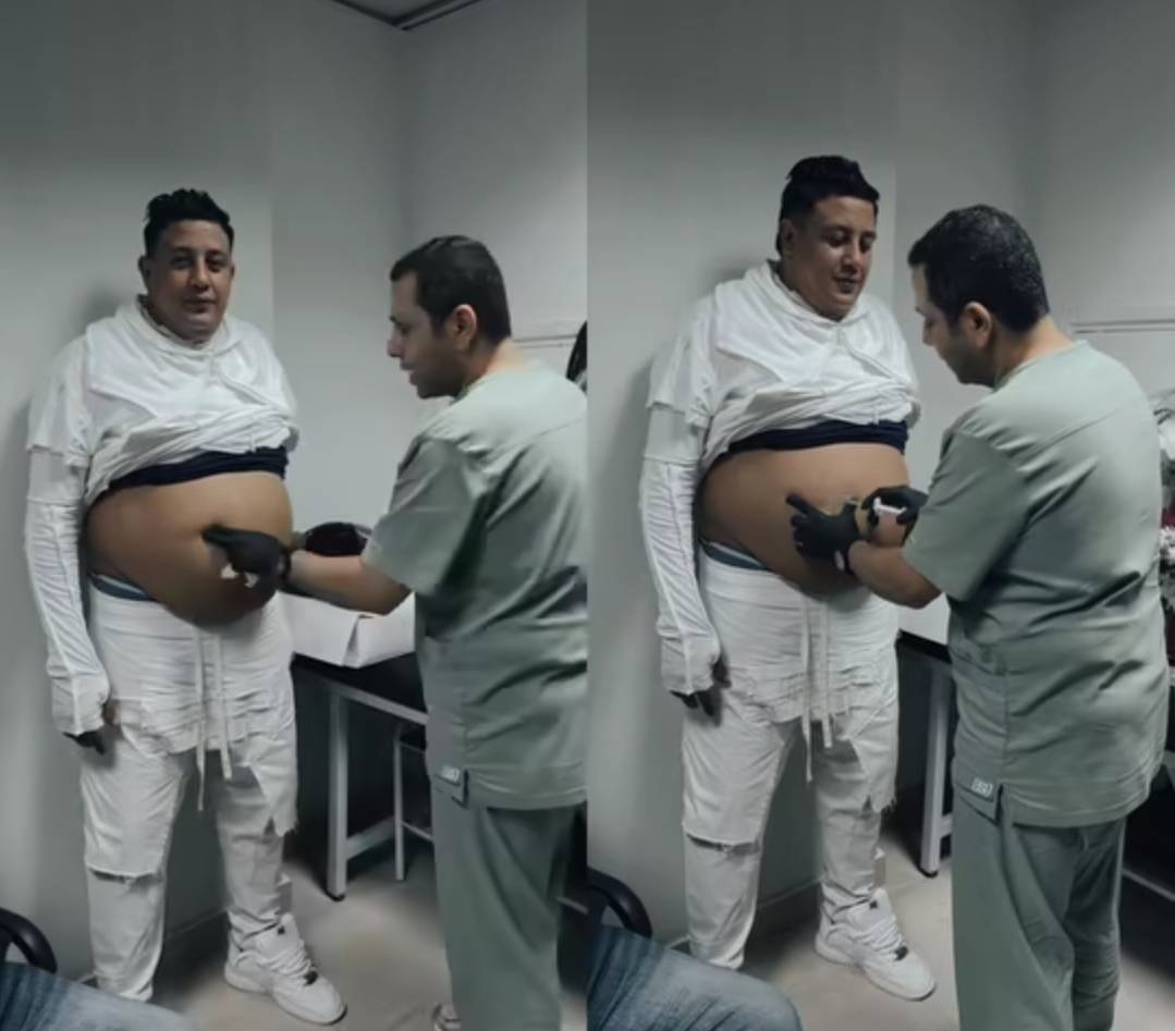 حمو بيكا قبل خسارة الوزن (سوشيال ميديا)