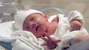 ما المضاعفات التي يمكن أن يتعرّض لها الطفل في حال الولادة المبكّرة؟