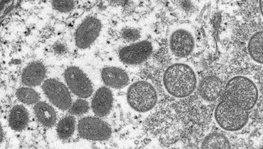 صورة مجهرية إلكترونية مقدمة من مراكز السيطرة على الأمراض والوقاية منها، تظهر جدري القردة في عينة سريرية مرتبطة بتفشي الفيروس بين كلاب البراري عام 2003 (أ ف ب). 