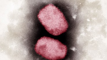 لقطة الكترونية مجهرية ملونة لفيروس جدري القردة تعود الى عام 2001 (معهد روبرت كوخ بألمانيا/  23 ايار 2022، أ ف ب).