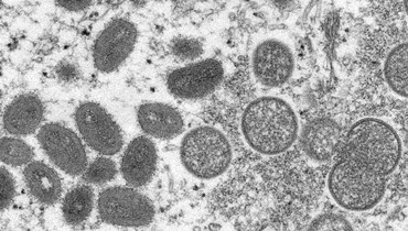 صورة لفيروس جدري القردة تحت مجهر إلكتروني، تعود الى عام 2003 (مراكز السيطرة على الأمراض والوقاية، أ ب). 