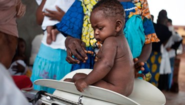 طفل يُعاني سوء تغذية في جمهورية أفريقيا الوسطى (2018 - أ ف ب).