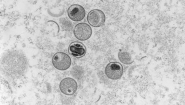صورة التُقطت عام 2004، وتمّ تسلّمها من معهد روبرت كوخ في 23 ايار 2022، وتُظهر لقطة إلكترونية مجهرية لفيروس جدري القردة (أ ف ب).
