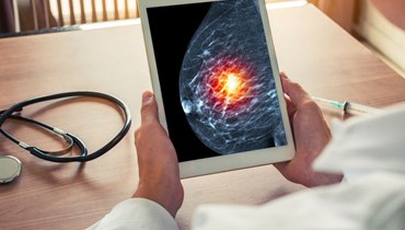 الموافقة على أول علاج موجه لنوع جديد من سرطان الثدي