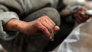 طفل يده مصابة يبحث عن مواد بلاستيكية لبيعها في محافظة إدلب شمال غرب سوريا (أ ف ب). 
