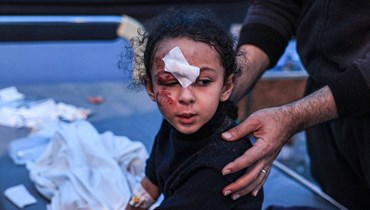  طفلة أصيبت خلال القصف الإسرائيلي تتلقّى العلاج في مستشفى الكويت في رفح بجنوب قطاع غزة (أ ف ب). 