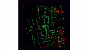 صورة قدمها معهد Altos Labs-Cambridge للعلوم تظهر خلية دبقية قليلة التغصن، وهي نوع من الخلايا المسؤولة عن المايلين في الجهاز العصبي المركزي (14 شباط 2024، أ ف ب). 