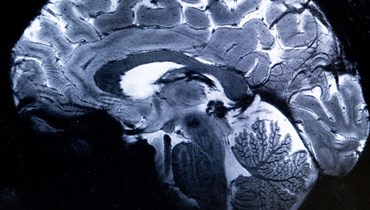 صورة ملتقطة بواسطة جهاز Iseult Magneton 11.7 T MRI، تظهر دماغاً خلال محاكاة اختبار التصوير بالرنين المغناطيسي (MRI) في مركز نوروسبين في جيف سور إيفيت (22 آذار 2024، ا ف ب). 