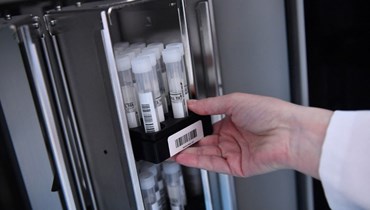 موظف يقوم بإدخال عينات من اللعاب في آلة في مختبر تحليل بطانة الرحم، جنوب غرب فرنسا (أ ف ب). 