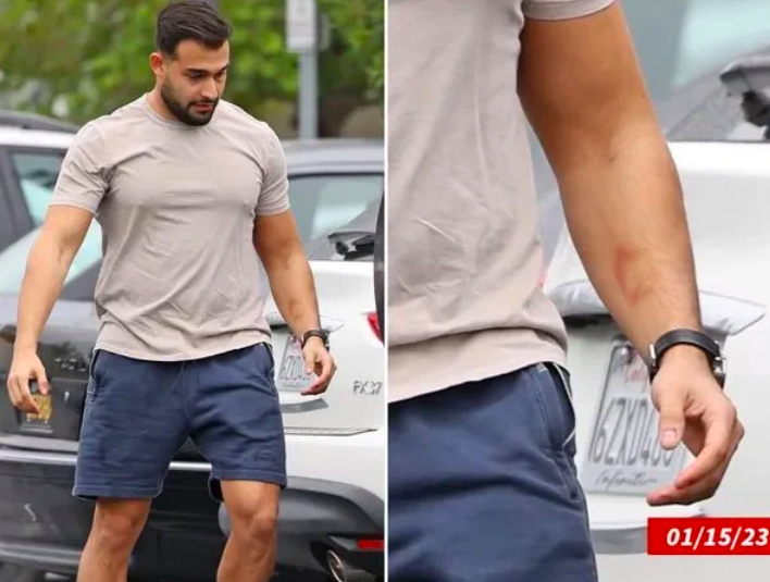 سام أصغري: بريتني سبيرز ضربتني وأنا نائم 1 سام أصغري: بريتني سبيرز ضربتني وأنا نائم