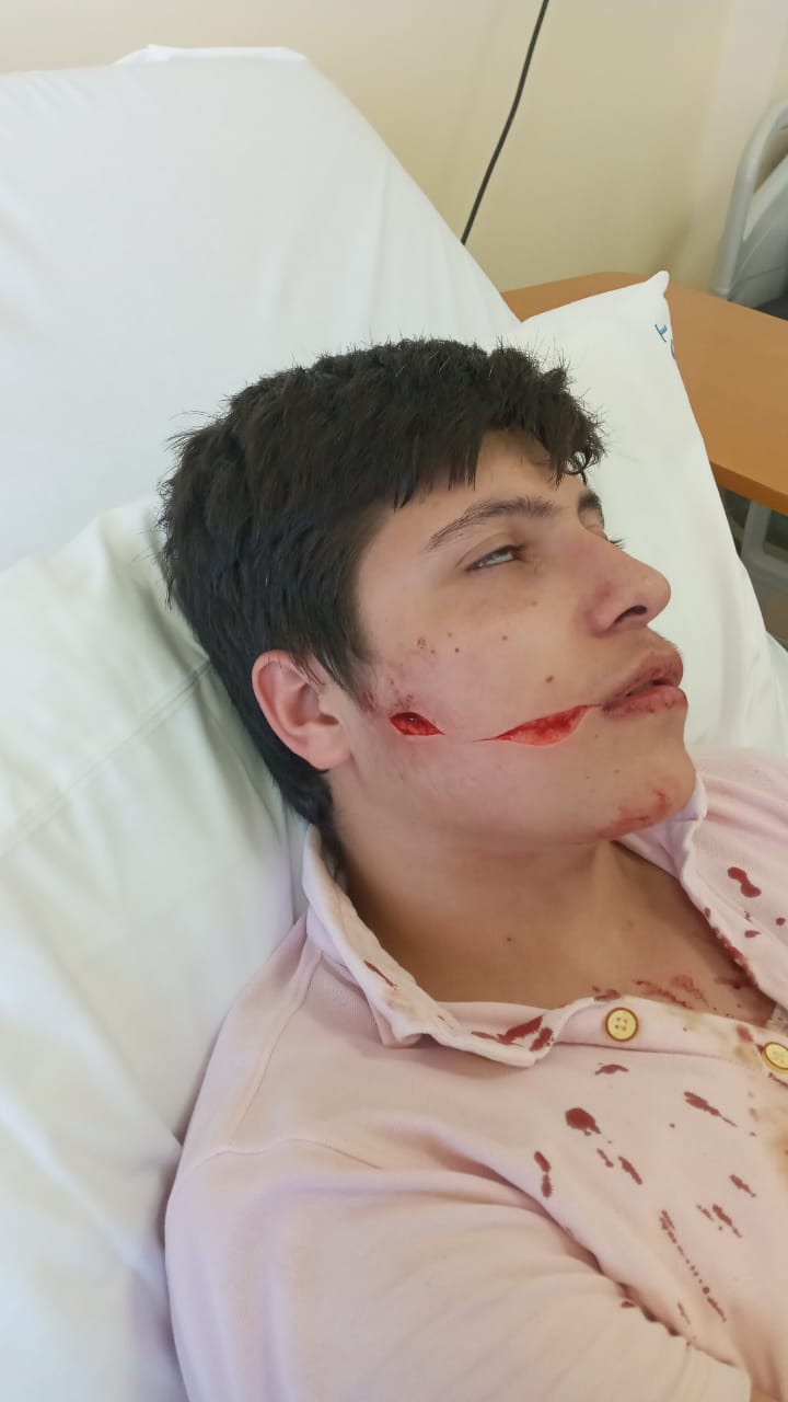 إشكال وسلاح أبيض أمام مدرسة في عكار... والحصيلة ثلاثة جرحى