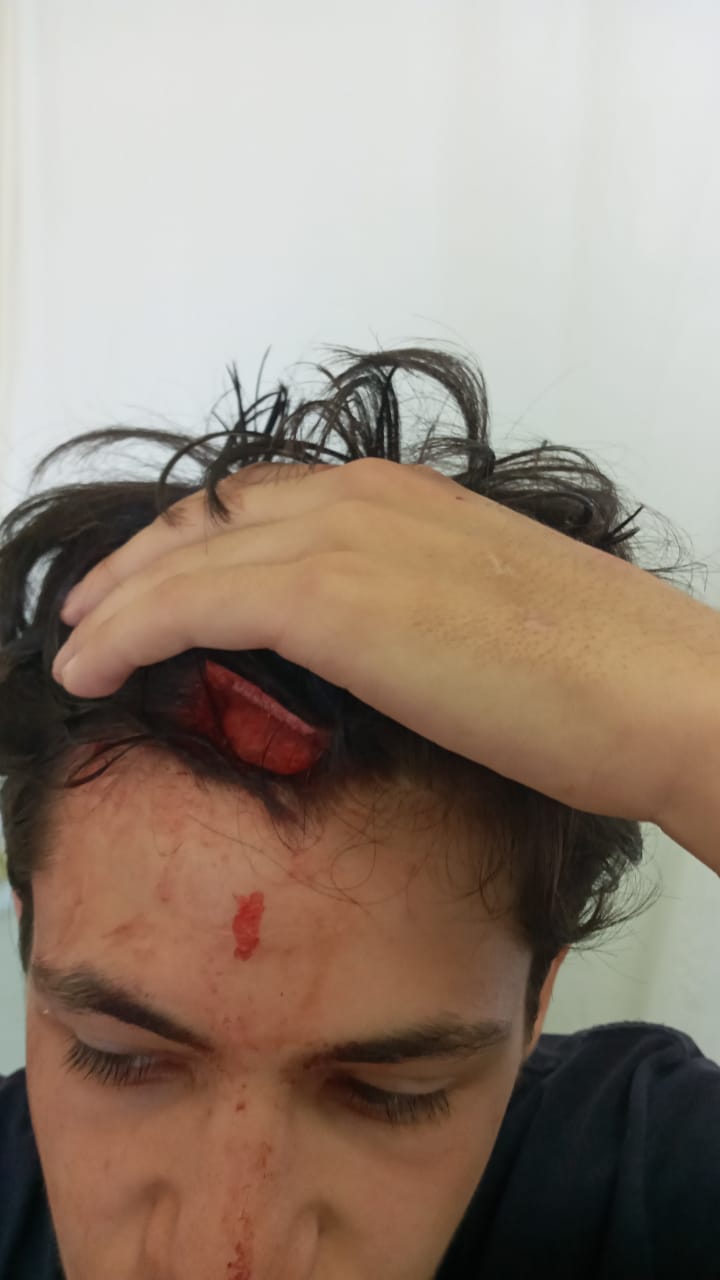 إشكال وسلاح أبيض أمام مدرسة في عكار... والحصيلة ثلاثة جرحى