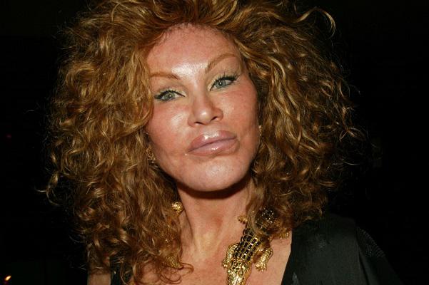  المرأة القطة قبل خضوعها للتجميل... ملامح طبيعية جميلة (صور)